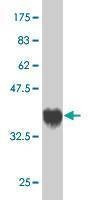 Anti-USP3 Antibody