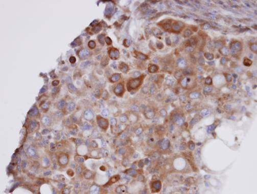Anti-GPX7 Antibody