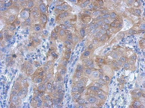Anti-IKK beta Antibody