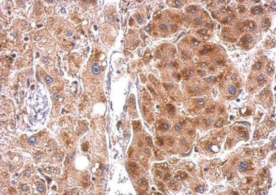 Anti-STAR Antibody