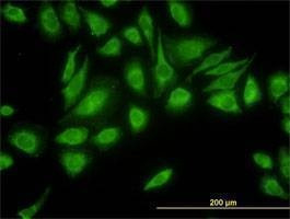 Anti-USP47 Antibody