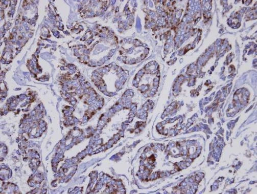 Anti-INPP1 Antibody