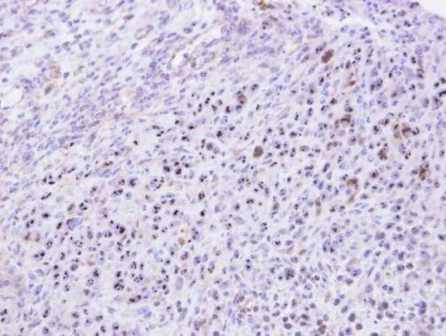 Anti-KRR1 Antibody