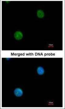 Anti-MYBPC2 (internal) Antibody