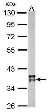 Anti-MDH2 Antibody