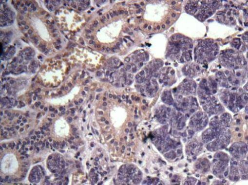 Anti-GPR114 Antibody