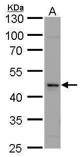 Anti-Calsequestrin-2 Antibody