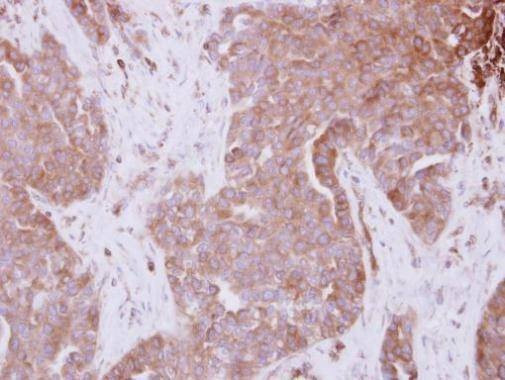 Anti-STAM Antibody