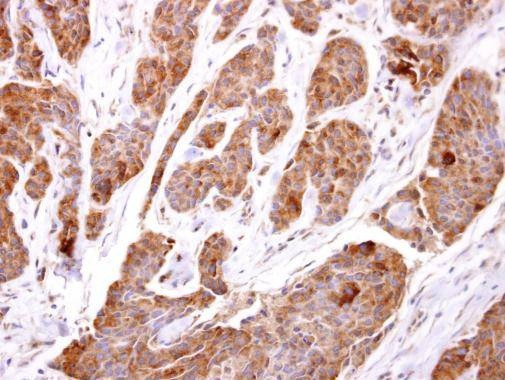 Anti-TBCC Antibody
