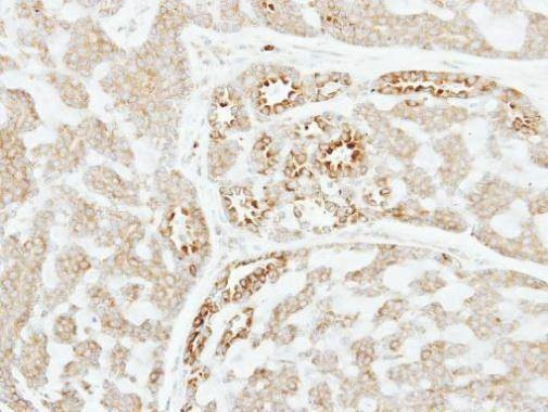 Anti-Factor XI Antibody