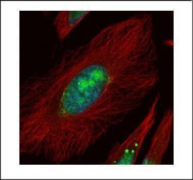 Anti-UTP6 Antibody