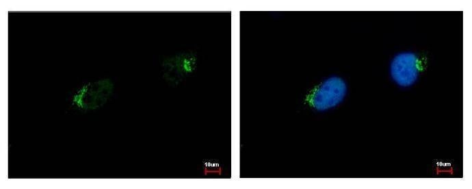 Anti-GALNT7 Antibody