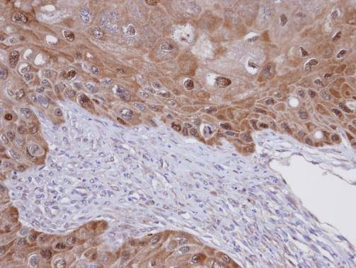Anti-IDI1 Antibody