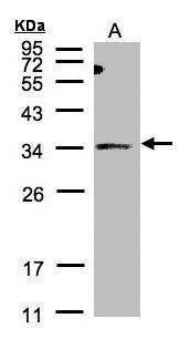 Anti-SIAT4A Antibody