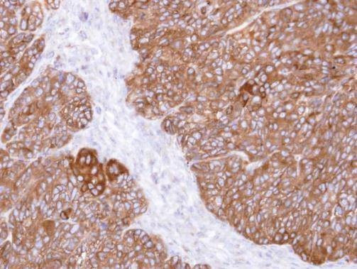 Anti-MIPP Antibody