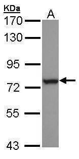 Anti-HSPA6 Antibody