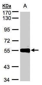 Anti-Carboxypeptidase M Antibody