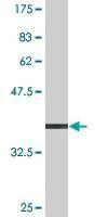 Anti-USP9X Antibody