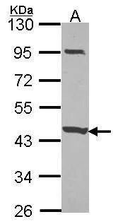 Anti-CCDC83 Antibody