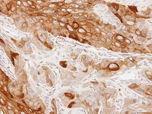 Anti-GAS2L1 Antibody