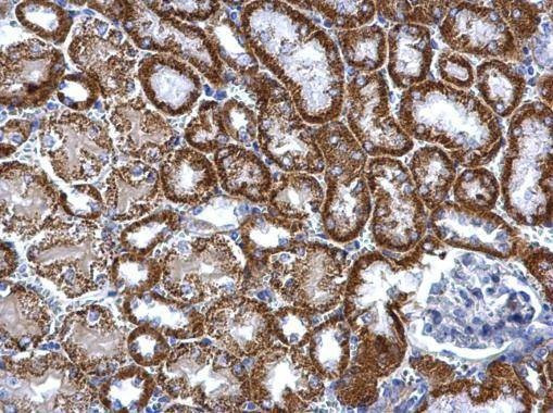 Anti-TST Antibody