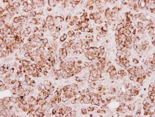Anti-TST Antibody
