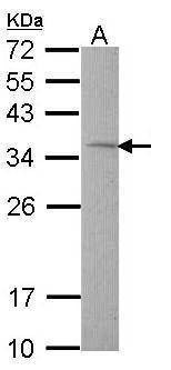 Anti-TST Antibody