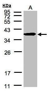 Anti-SPFH2 (C-term) Antibody