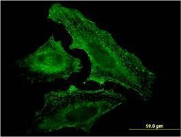Anti-UVRAG Antibody