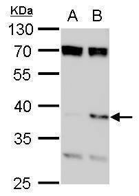 Anti-SET Antibody