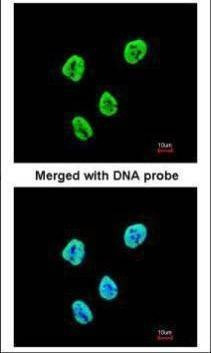 Anti-SET Antibody