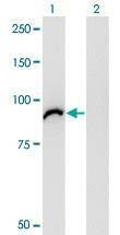Anti-VAC14 Antibody