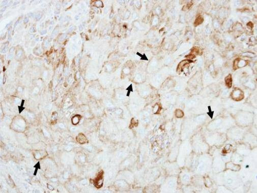 Anti-GIPC1 Antibody