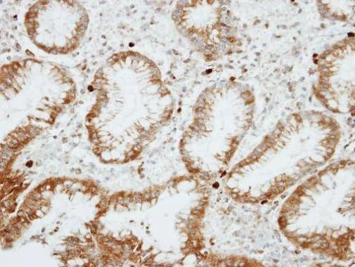 Anti-RGS14 (C-term) Antibody