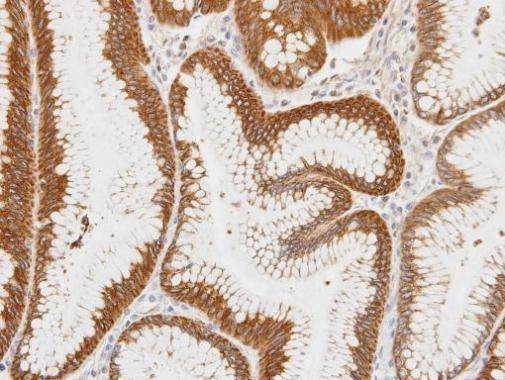 Anti-Centaurin alpha 1 (C-term) Antibody