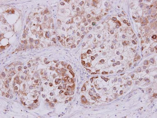 Anti-STMN2 Antibody