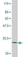 Anti-VASN Antibody