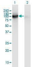 Anti-VASN Antibody