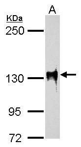 Anti-SAP130 (C-term) Antibody