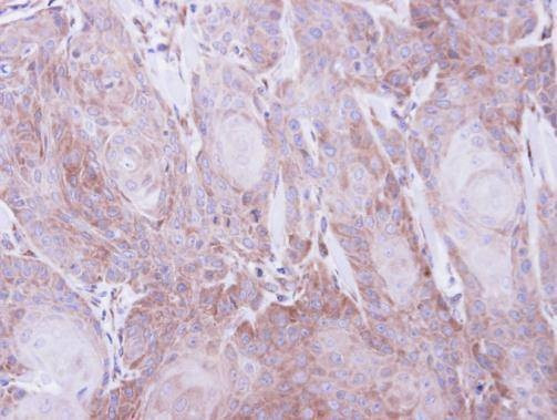 Anti-SEC61A1 Antibody