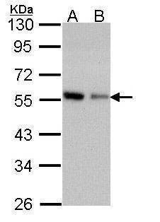 Anti-Coronin 1C (C-term) Antibody