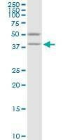 Anti-VAT1 Antibody