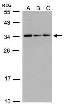 Anti-CIP29 Antibody