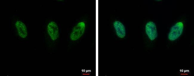 Anti-CIP29 Antibody
