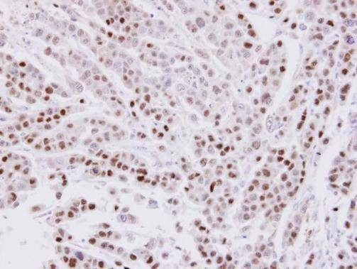 Anti-CIP29 Antibody