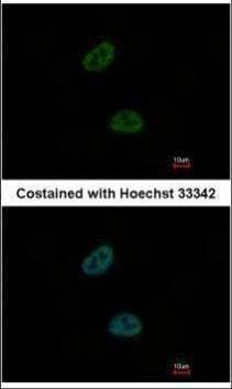 Anti-C20orf11 Antibody