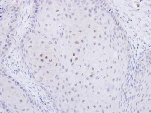 Anti-C20orf11 Antibody