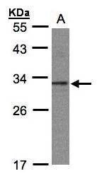 Anti-C20orf11 Antibody