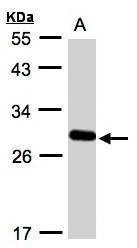 Anti-YIPF4 Antibody