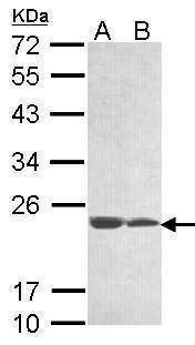 Anti-LOC283129 Antibody
